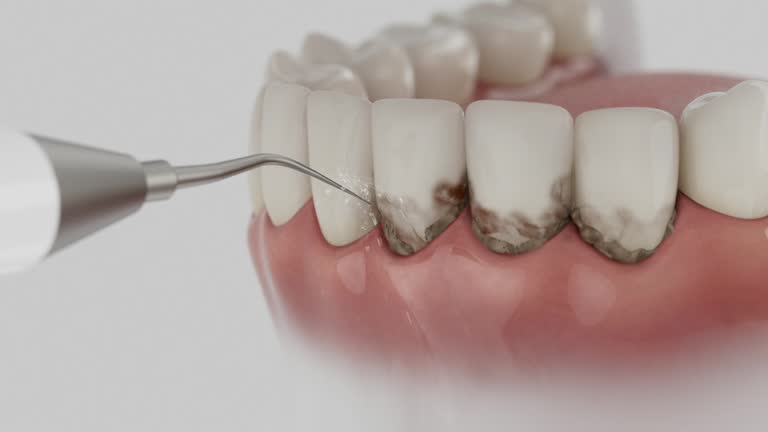 Trusted Invisalign Clear Aligners service in Jonestown, PA - Dentist Open Now